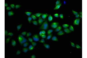Immunofluorescence staining of Hela cells with ABIN7174520 at 1:66, counter-stained with DAPI. (UBA1 anticorps  (AA 730-881))