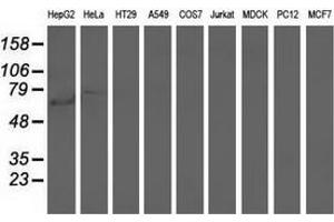Western blot analysis of extracts (35 µg) from 9 different cell lines by using anti-ARHGAP25 monoclonal antibody. (ARHGAP25 anticorps)