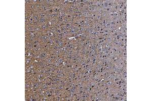 IHC analysis of TTC7B using anti-TTC7B antibody (ABIN7601050). (TTC7B anticorps  (AA 275-730))