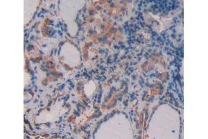 Used in DAB staining on fromalin fixed paraffin- embedded thyroid tissue (CD164 anticorps  (AA 24-162))