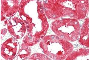 anti-Aldehyde Dehydrogenase 1 Family, Member L1 (ALDH1L1) antibody