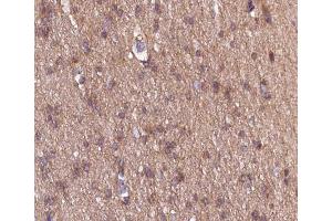 ABIN6266533 at 1/100 staining human brain tissue sections by IHC-P. (COL18A1 anticorps  (C-Term))