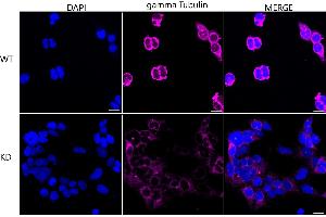 anti-Tubulin, gamma (TUBG) antibody