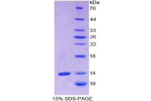 SDS-PAGE analysis of Human Olfactomedin 4 Protein.