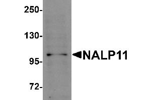 Western Blotting (WB) image for anti-NLR Family, Pyrin Domain Containing 11 (NLRP11) (C-Term) antibody (ABIN1030531)