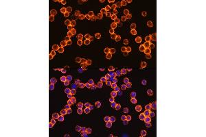 Immunofluorescence analysis of R.