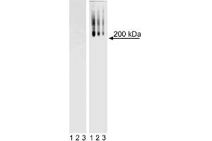 Western Blot analysis of TRA-1-60 in mouse and human ES cell lines. (TRA1-60 anticorps)