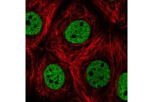 Immunofluorescent staining of MCF7 cells with HNRNPC monoclonal antibody, clone CL2596  (Green) shows distinct nuclear (without nucleoli).