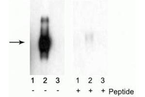 Western blot of immunoprecipitates from HEK 293 cells transfected with 1) Mock, 2) IFNAR1 WT, and 3) IFNAR1 S535A and S539A mutants. (IFNAR1 anticorps  (pSer535, pSer539))