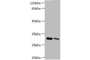 Western blot All lanes: Chloride intracellular channel protein 4 antibody at 5 μg/mL Lane 1: Mouse kidney tissue Lane 2: Mouse ovarian tissue Secondary Goat polyclonal to rabbit IgG at 1/10000 dilution Predicted band size: 29 kDa Observed band size: 29 kDa