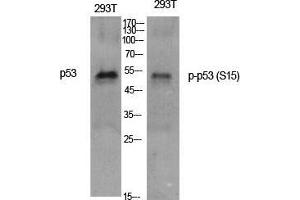 Western Blot (WB) analysis of specific cells using Phospho-p53 (S15) Polyclonal Antibody.