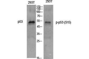 Western Blot (WB) analysis of specific cells using Phospho-p53 (S15) Polyclonal Antibody. (p53 anticorps  (pSer15))