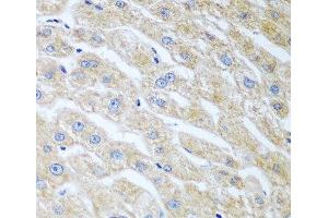 Immunohistochemistry of paraffin-embedded Human liver using UCHL3 Polyclonal Antibody at dilution of 1:100 (40x lens). (UCHL3 anticorps)