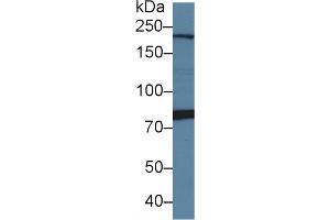 Detection of PI4Ka in Rat Cerebrum lysate using Polyclonal Antibody to Phosphatidylinositol-4-Kinase Catalytic Alpha (PI4Ka) (PI4KA anticorps  (AA 1-300))