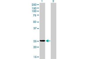 Western Blot analysis of PSPH expression in transfected 293T cell line by PSPH monoclonal antibody (M02), clone 2G9. (PSPH anticorps  (AA 1-225))