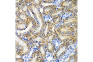 Immunohistochemistry of paraffin-embedded rat kidney using FAH antibody at dilution of 1:100 (x40 lens). (FAH anticorps)