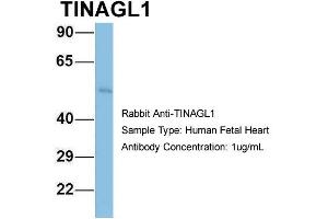Host: Rabbit Target Name: TINAGL1 Sample Type: Human Fetal Heart Antibody Dilution: 1. (TINAGL1 anticorps  (Middle Region))