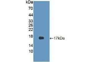 Detection of Recombinant CDKN2B, Mouse using Polyclonal Antibody to Cyclin Dependent Kinase Inhibitor 2B (CDKN2B)