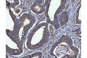 IHC analysis of HMGCR using anti-HMGCR antibody (ABIN7600989). (HMGCR anticorps  (AA 268-842))