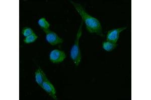 IF analysis of HSD3B1 using anti-HSD3B1 antibody (ABIN7600267).