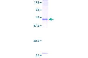 Growth Differentiation Factor 15 (GDF15) (AA 31-308) protein (GST tag)