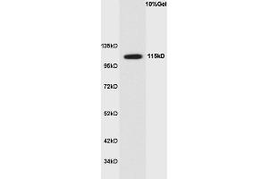 Human colon cancer lysate probed with Anti Phospho-Ack1(Tyr284) Polyclonal Antibody, Unconjugated  at 1:3000 for 90 min at 37˚C. (TNK2 anticorps  (pTyr284))