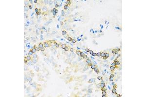 Immunohistochemistry of paraffin-embedded mouse testis using FMRP antibody (ABIN6133703, ABIN6140719, ABIN6140721 and ABIN6221705) at dilution of 1:100 (40x lens).