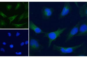 ABIN185240 Immunofluorescence analysis of paraformaldehyde fixed HeLa cells, permeabilized with 0. (GAPDH anticorps  (C-Term))