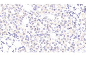 Detection of TNC in Rat Kidney Tissue using Polyclonal Antibody to Tenascin C (TNC) (TNC anticorps  (AA 175-342))