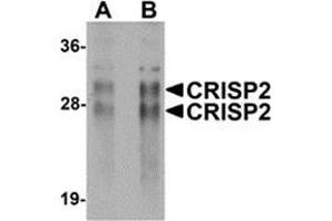 Western blot analysis of CRISP2 in human testis tissue lysate with CRISP2 antibody at (A) 0.