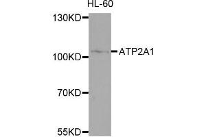 Western blot analysis of extracts of HL-60 cells, using ATP2A1 antibody.