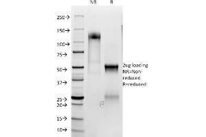 SDS-PAGE Analysis Purified CD3e Rabbit Polyclonal Antibody Confirmation of Purity and Integrity of Antibody.