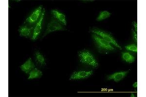 Immunofluorescence of monoclonal antibody to SQSTM1 on HeLa cell. (SQSTM1 anticorps  (AA 1-440))