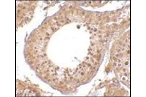Immunohistochemistry of RGPD5 in human testis tissue cells with this product at 10 μg/ml. (RGPD5 / RGPD6 (N-Term) anticorps)