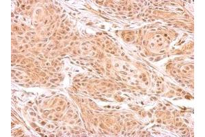 IHC-P Image ZNF134 antibody detects ZNF134 protein at cytosol on Cal27 xenograft by immunohistochemical analysis. (ZNF134 anticorps)