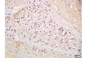Formalin-fixed and paraffin embedded human stomach labeled with Anti EEA1 Polyclonal Antibody, Unconjugated (ABIN1385839) at 1:200 followed by conjugation to the secondary antibody and DAB staining.