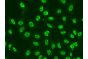 Immunofluorescence analysis of A549 cells using CHEK2 antibody. (CHEK2 anticorps)