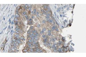 ABIN6276452 at 1/100 staining Human prostate tissue by IHC-P. (TPMT anticorps  (N-Term))