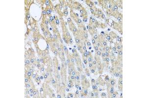Immunohistochemistry of paraffin-embedded human liver injury using UQCRC2 antibody.