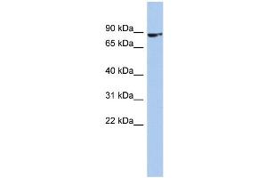 WB Suggested Anti-ZNF189 Antibody Titration:  0. (ZNF189 anticorps  (Middle Region))