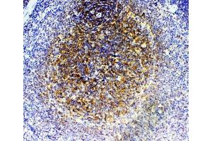 IHC analysis of GRK2 using anti-GRK2 antibody (ABIN5693069).