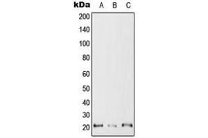 Western blot analysis of RAC2 expression in Jurkat (A), SP2/0 (B), H9C2 (C) whole cell lysates. (RAC2 anticorps  (C-Term))