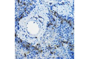 Immunohistochemistry of paraffin-embedded mouse spleen using β-TrCP/BTRC Rabbit pAb (ABIN3022333, ABIN3022334, ABIN3022335 and ABIN6218745) at dilution of 1:100 (40x lens).