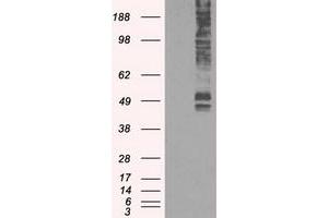 Image no. 1 for anti-Solute Carrier Family 2 (Facilitated Glucose/fructose Transporter), Member 5 (SLC2A5) antibody (ABIN1498479)