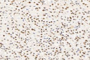 Immunohistochemistry analysis of paraffin-embedded human liver using,SET (ABIN7075583) at dilution of 1: 10000