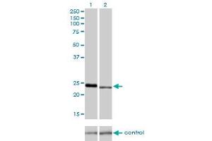 Western blot analysis of RAB7L1 over-expressed 293 cell line, cotransfected with RAB7L1 Validated Chimera RNAi (Lane 2) or non-transfected control (Lane 1). (RAB7L1 anticorps  (AA 1-203))