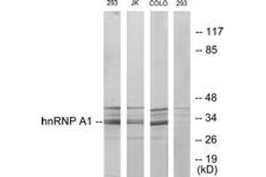 Western blot analysis of extracts from 293/Jurkat/COLO205 cells, using hnRNP A1 Antibody.