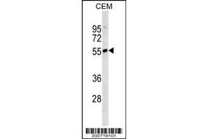 Western Blotting (WB) image for Mouse anti-Human IgD (AA 37-64) antibody (ABIN1498831)