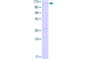 Image no. 1 for Bromodomain Containing 2 (BRD2) (AA 1-801) protein (GST tag) (ABIN1346853)
