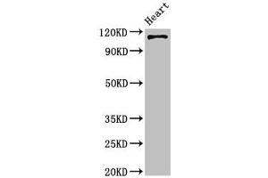 Western Blot Positive WB detected in: Mouse heart tissue All lanes: ITGA5 antibody at 4 μg/mL Secondary Goat polyclonal to rabbit IgG at 1/50000 dilution Predicted band size: 115 kDa Observed band size: 115 kDa (ITGA5 anticorps  (AA 220-472))